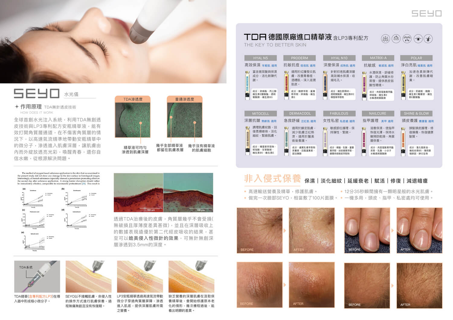 SEYO水光儀是什麼 TDA專利透皮技術 其特點有哪些