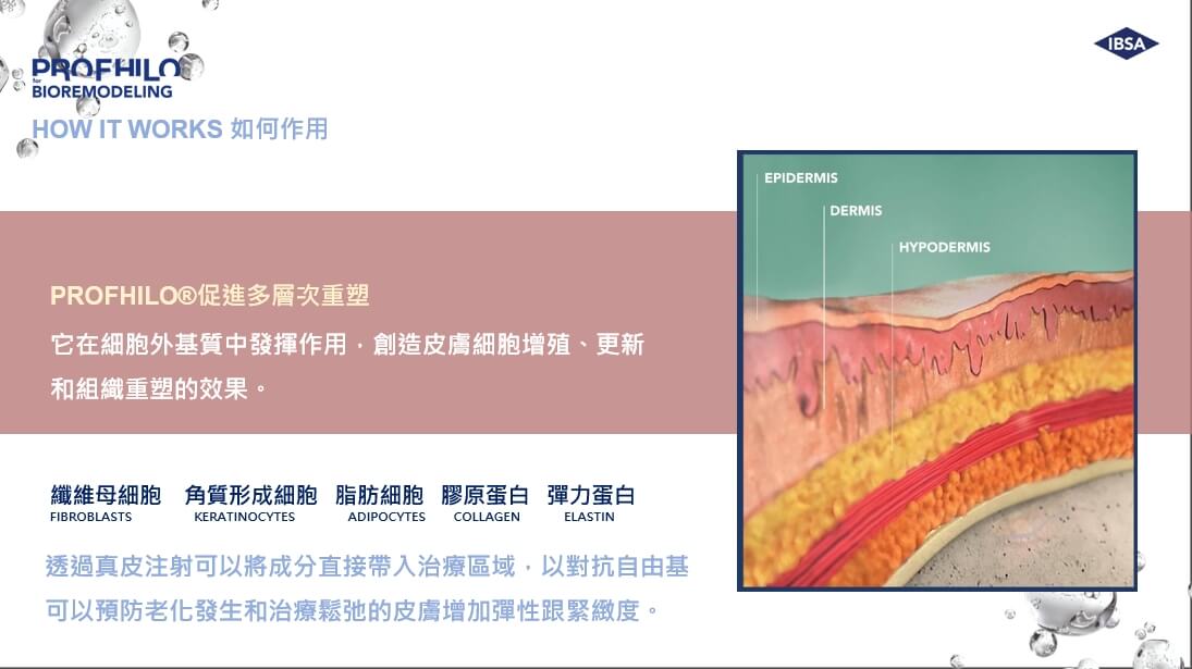 什麼是 Profhilo® 逆時針？為什麼這麼多人想做？由內而外的再生醫美