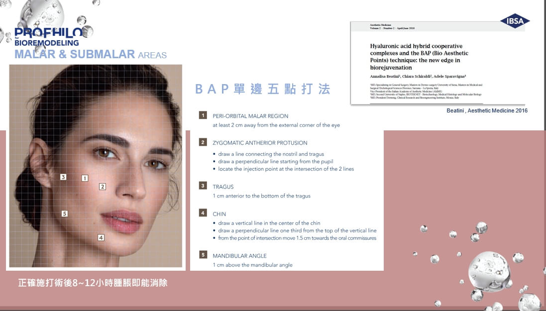 什麼是 Profhilo® 逆時針？為什麼是這麼多人想要做的療程？由內而外的再生醫美