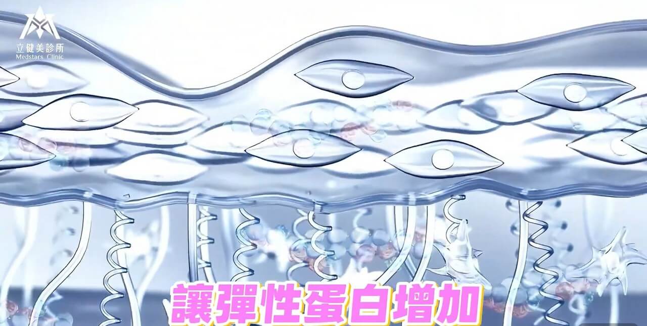 「逆時針」網友們瘋傳的美麗秘密 連闆娘Jasmine都想打的醫美服務