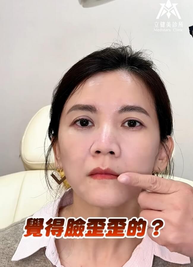 台北松山區醫美推薦 網紅貝貝想改善的「鏡頭臉歪」!蔡院長揭秘:1:1.25 黃金美唇才是平衡關鍵